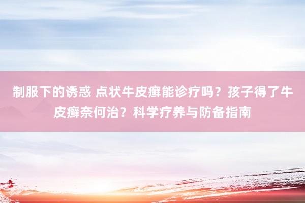 制服下的诱惑 点状牛皮癣能诊疗吗？孩子得了牛皮癣奈何治？科学疗养与防备指南